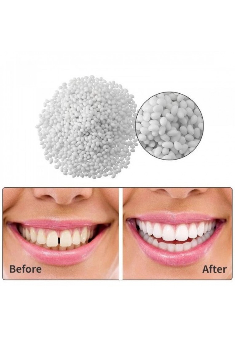 50g Tooth Repair Kit Dental Care Glue for Filling Missing Broken Crowns and Bridges Moldable